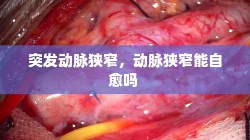 突发动脉狭窄，动脉狭窄能自愈吗 